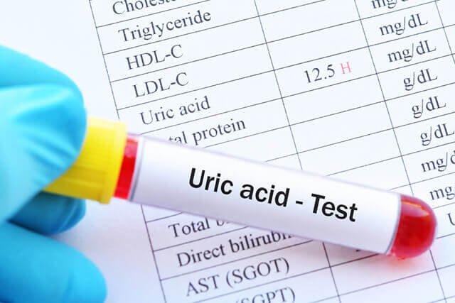 Tổng hợp những cách làm giảm acid uric trong máu