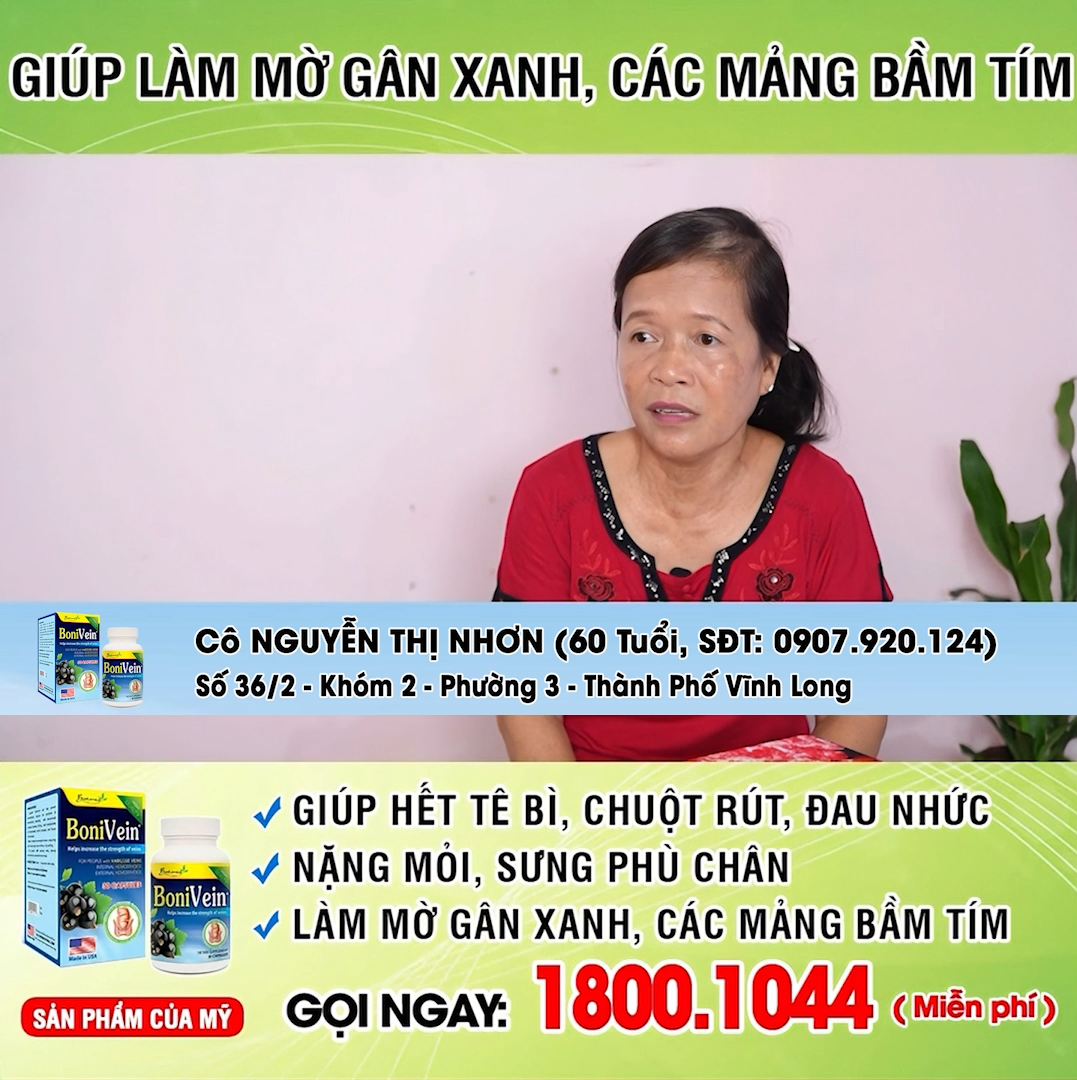 Bí quyết đẩy lùi suy giãn tĩnh mạch - tự tin bước đi mỗi ngày!