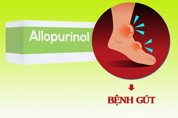 Allopurinol có tác dụng như thế nào với người bệnh gút?