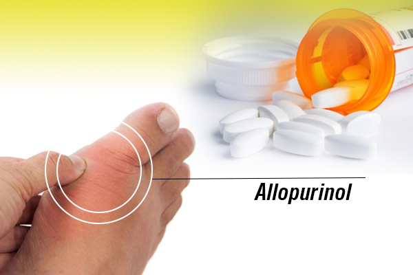 Cơ chế hạ acid uric máu của Allopurinol là gì?