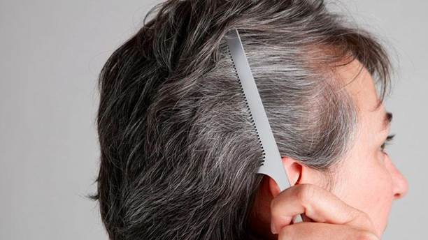Hà thủ ô trị tóc bạc sớm có hiệu quả không? Bài thuốc nào hay được sử dụng?