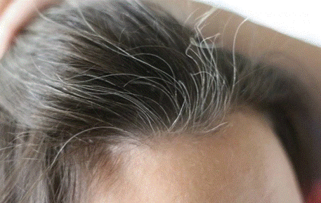 Mách bạn TOP 5 TPCN thuốc trị tóc bạc sớm an toàn lành tính và hiệu quả