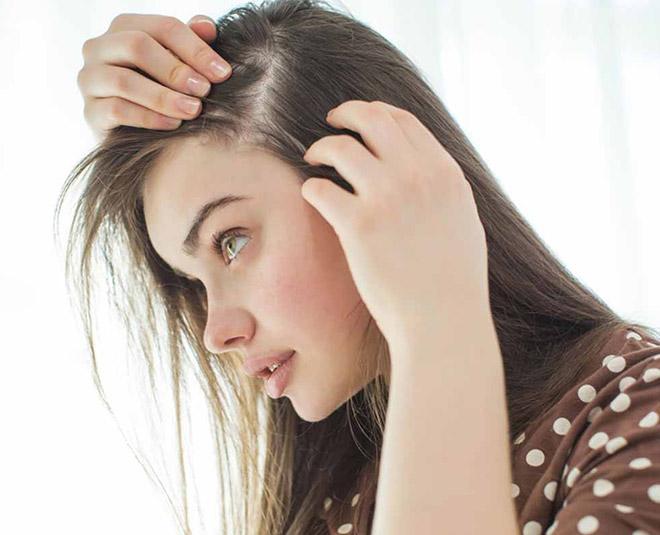 Chân tóc yếu: Nguyên nhân và cách khắc phục hiệu quả nhất