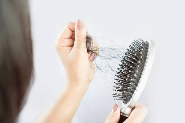 Phải làm sao để ngăn rụng tóc hiệu quả?