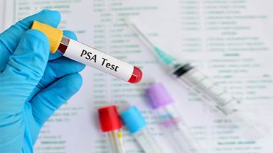 PSA test dùng trong chẩn đoán ung thư tuyến tiền liệt