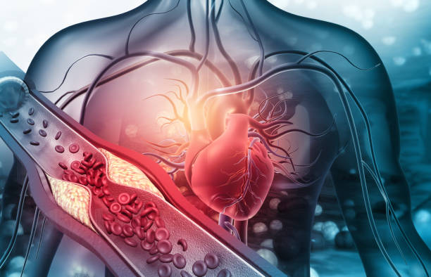 Lycopene giúp giảm nguy cơ mắc bệnh tim mạch