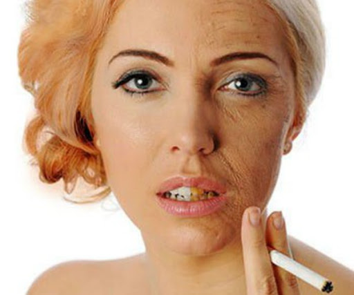 Hút thuốc lá đẩy nhanh quá trình lão hóa ở phụ nữ