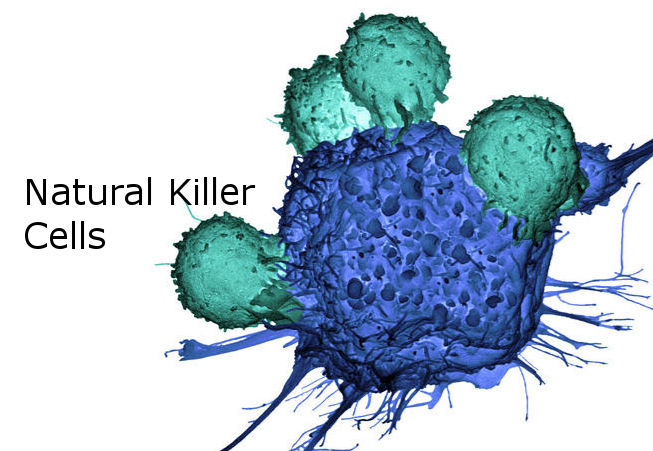 Tế bào NK giúp tiêu diệt, ngăn chặn hình thành và phát triển của các tế bào ung thư.