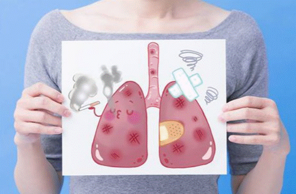 Nguyên nhân nhiễm độc phổi phổ biến nhất là gì? Làm thế nào để hỗ trợ giải độc phổi hiệu quả?