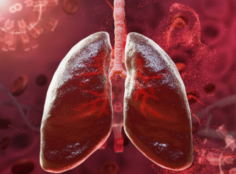 Phổi bị nhiễm độc là nguyên nhân phổi yếu phổ biến nhất