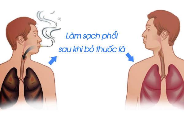 Sau khi bỏ thuốc lá, lá phổi có thể phục hồi hoàn toàn không?