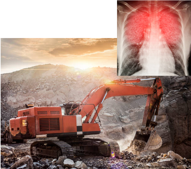 Bệnh bụi phổi silic là gì?
