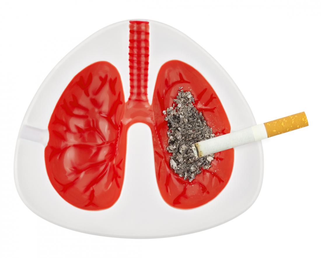 Thuốc lá là nguyên nhân gây ung thư phổi