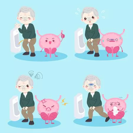 Tổng hợp dấu hiệu nhận biết u xơ tuyến tiền liệt nam giới cần biết