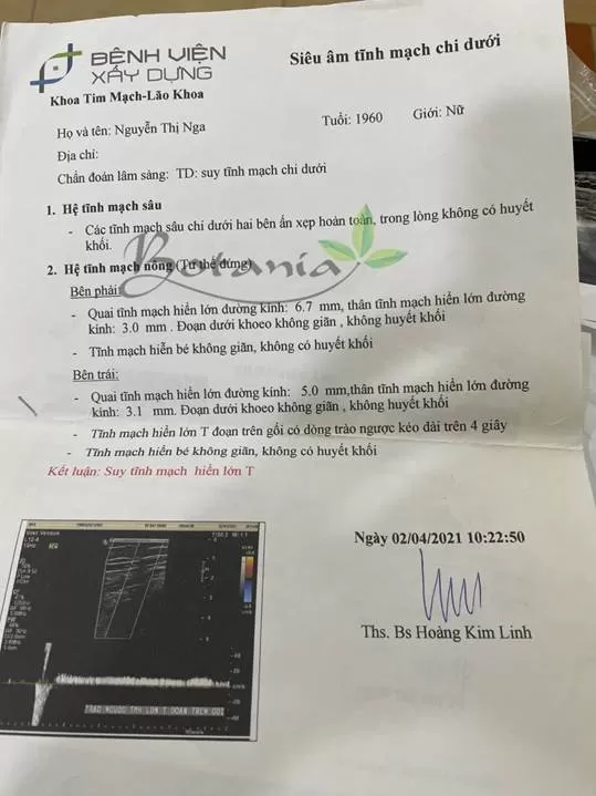 Kết quả siêu âm bị suy giãn tĩnh mạch hiển lớn của cô Nga