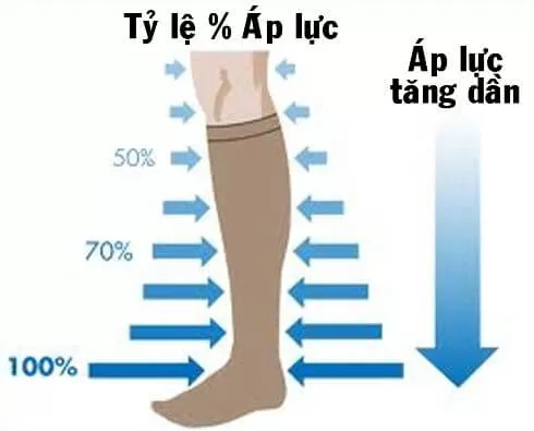 Thận trọng khi dùng tất áp lực hỗ trợ điều trị giãn tĩnh mạch chân