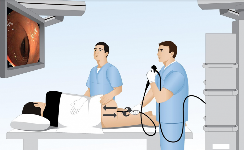 Cách chẩn đoán viêm đại tràng cấp tính