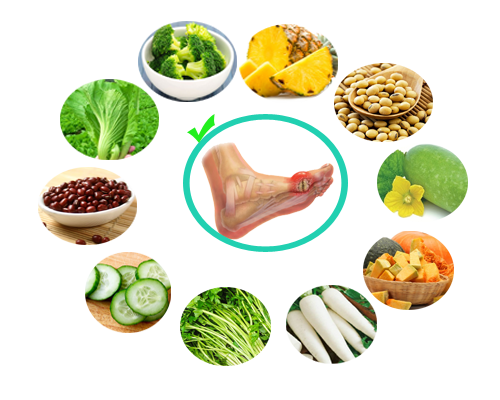 Bệnh gút và chế độ ăn uống: nên ăn gì, kiêng gì ?