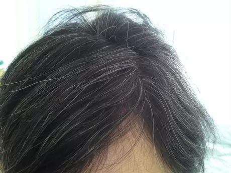 Hỏi: Dùng BoniHair 6 tháng chân tóc đã đổi màu, tôi có tiếp tục uống BoniHair nữa hay không?