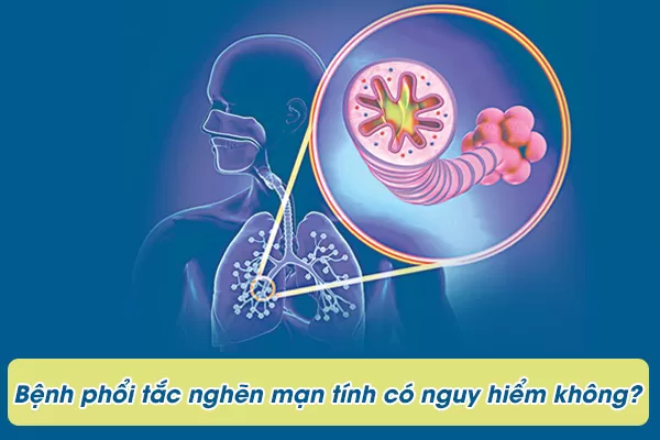 Bệnh phổi tắc nghẽn mạn tính có nguy hiểm không?